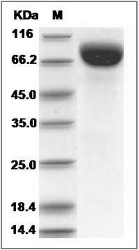 Human Biotinidase / Biotinase / BTD Protein (His Tag) SDS-PAGE