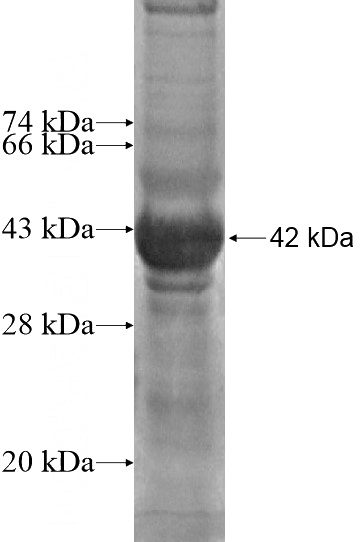 Recombinant Human GTF3C4 SDS-PAGE