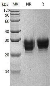Human FCGR2B/CD32/FCG2/IGFR2 (His tag) recombinant protein