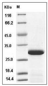 Human PPM1G / PP2C-gamma Protein (aa 317-546, His Tag) SDS-PAGE