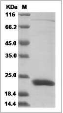 Human OBP2B / Odorant-binding protein 2b Protein (His Tag) SDS-PAGE