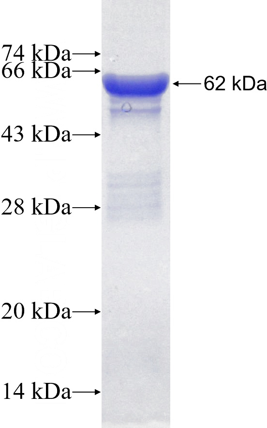 Recombinant Human COL6A1 SDS-PAGE