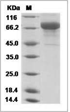 Influenza A H3N2 (A/Wisconsin/67/X-161/2005) Hemagglutinin / HA Protein (His Tag)