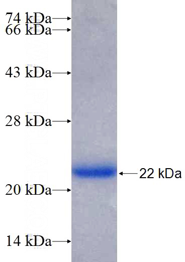Recombinant Human ALMS1 SDS-PAGE