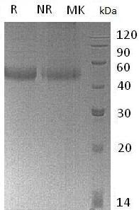 Human Galectin-9 (His tag) recombinant protein