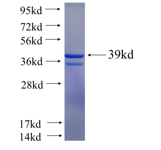 Recombinant human RPL30(Full length) SDS-PAGE