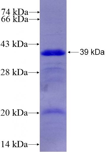 Recombinant Human CYP4F12 SDS-PAGE