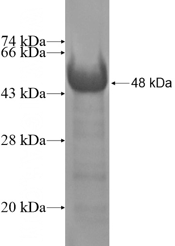 Recombinant Human C9orf156 SDS-PAGE