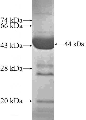 Recombinant Human RPS6KL1 SDS-PAGE