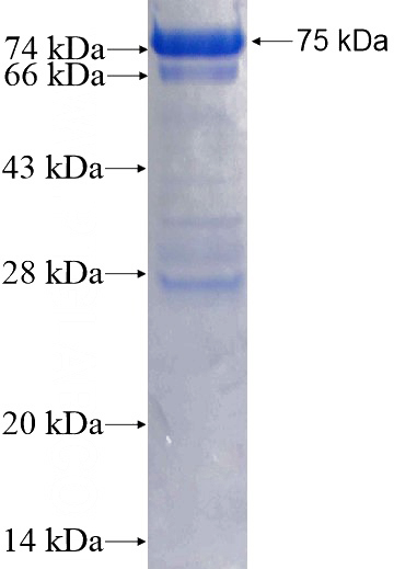 Recombinant Human Cyclin A2 SDS-PAGE