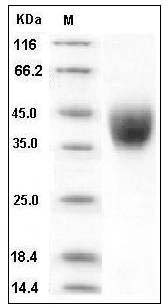 Human IFNGR1 / CD119 Protein (His Tag) SDS-PAGE