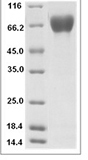 H3N2 HA Protein 15911