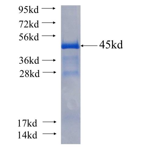 Recombinant human RORB SDS-PAGE