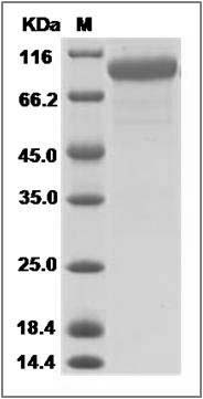 Canine HER2 / ErbB2 Protein (His Tag) SDS-PAGE