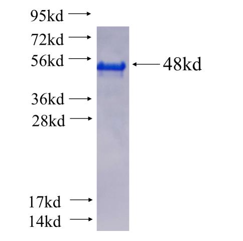 Recombinant human CHMP1B(Full length) SDS-PAGE