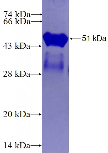 Recombinant Human LRRC48 SDS-PAGE