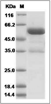 Rat Ephrin-B3 / EFNB3 Protein (Fc Tag) SDS-PAGE