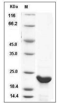 Human N6AMT1 / HEMK2 Protein (His Tag) SDS-PAGE