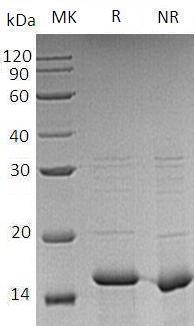 Human CDK2AP1/CDKAP1/DOC1 (His tag) recombinant protein