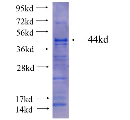 Recombinant human C1orf106 SDS-PAGE