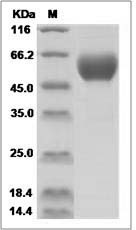 Influenza A H3N8 (A/equine/Gansu/7/2008) Hemagglutinin Protein (HA1 Subunit) (His Tag) SDS-PAGE