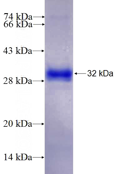 Recombinant Human PDSS2 SDS-PAGE