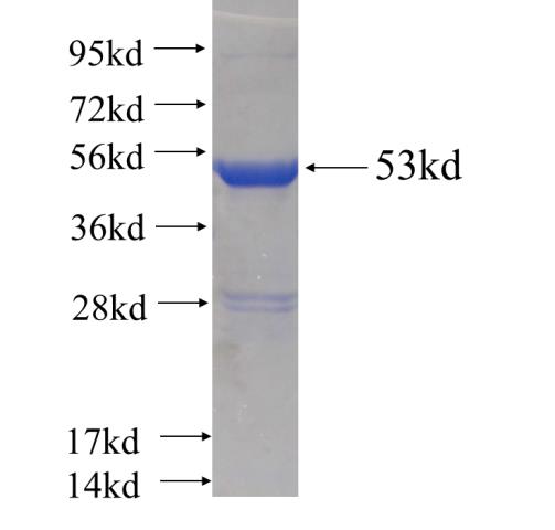 Recombinant human SNX5(Full length) SDS-PAGE