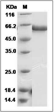 Influenza A H7N9 (A/Hangzhou/1/2013) Hemagglutinin / HA Protein (His Tag) SDS-PAGE