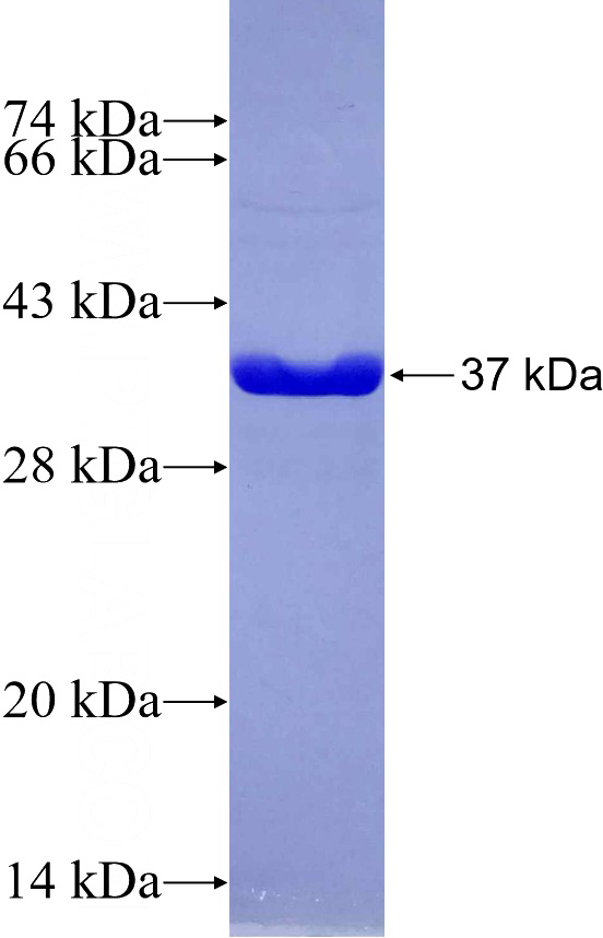 Recombinant Human P16-INK4A SDS-PAGE
