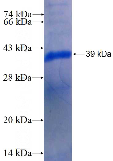 Recombinant Human SGEF SDS-PAGE