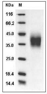 Mouse CD16 / FCGR3 Protein (His Tag) SDS-PAGE