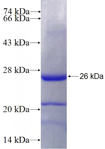 Recombinant Human MSH5 SDS-PAGE
