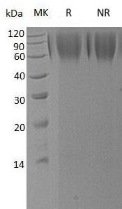 Human LAMP1 (His tag) recombinant protein