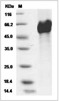 Human LRP11 Protein (His Tag) SDS-PAGE