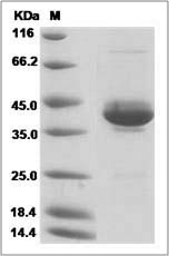 Human NRG-3 / Neuregulin-3 Protein (Fc Tag) SDS-PAGE
