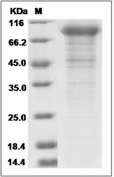Rat Cadherin-6 / CDH6 Protein (His Tag)