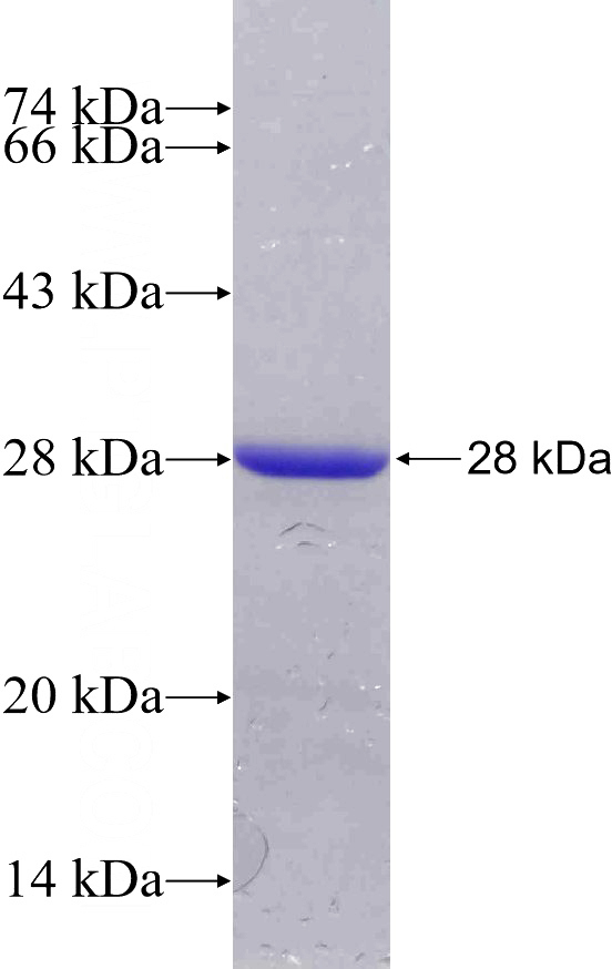 Recombinant Human XIRP2 SDS-PAGE