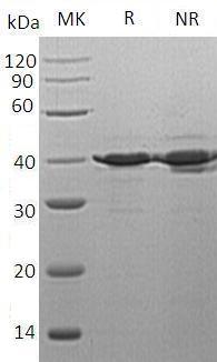Human TSTA3/SDR4E1 (His tag) recombinant protein