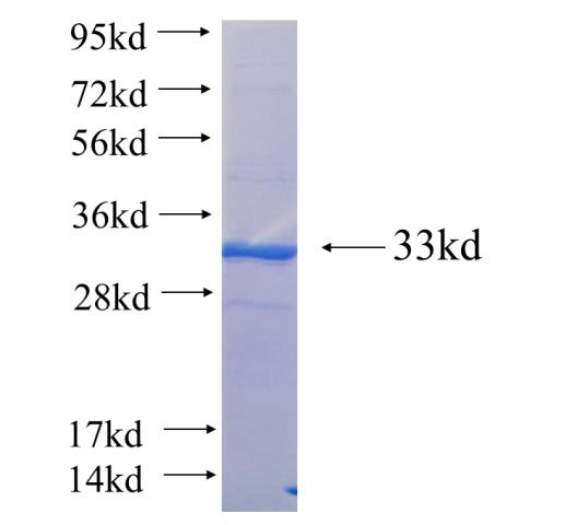 Recombinant human IL8RB SDS-PAGE