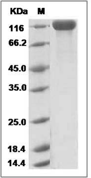 Mouse Siglec-2 / CD22 Protein (His Tag) SDS-PAGE