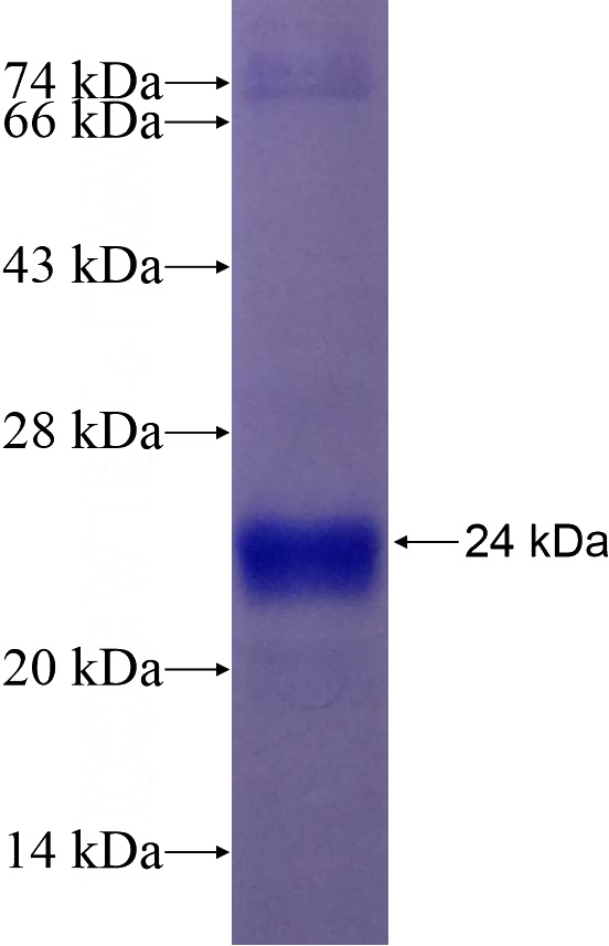 Recombinant Human CDC14A SDS-PAGE