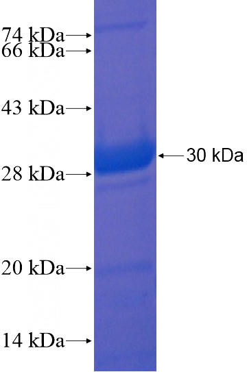 Recombinant Human METTL12 SDS-PAGE