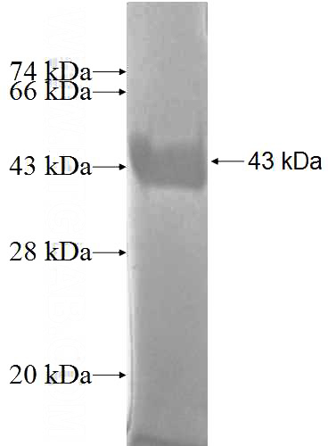 Recombinant Human IL-1F5 SDS-PAGE
