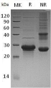 Human WBP1 (His tag) recombinant protein