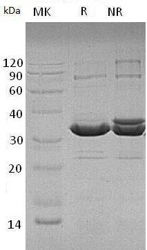 Human ATF1 (His tag) recombinant protein