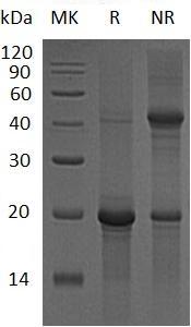 Human PRKCE/PKCE (His tag) recombinant protein