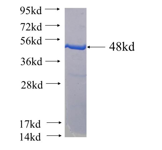 Recombinant human PDCD6(Full length) SDS-PAGE