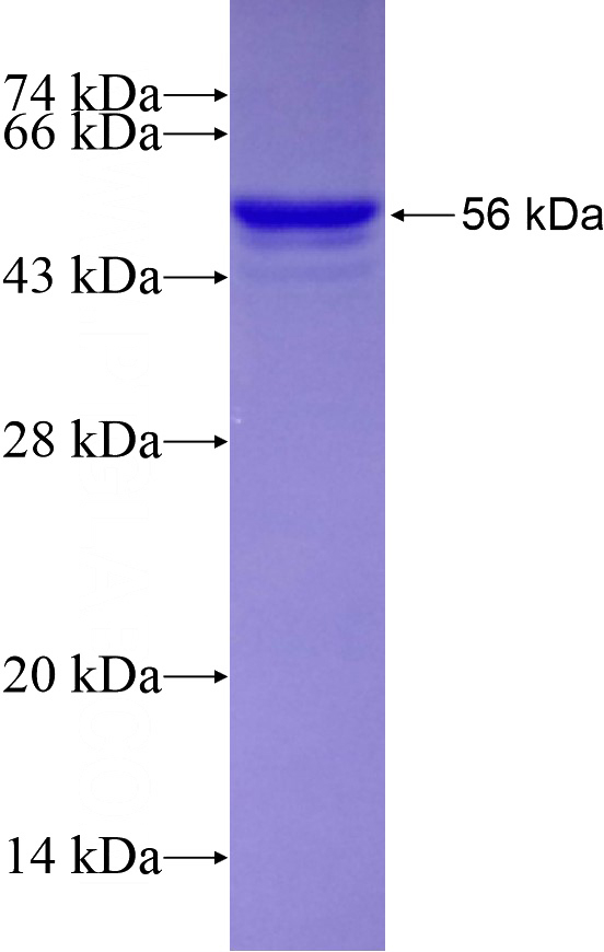 Recombinant Human SSRP1 SDS-PAGE