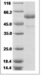 Human TSH Receptor/TSHR Protein 14490