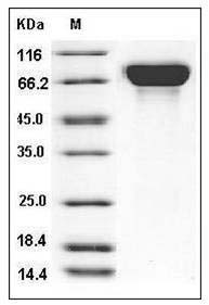 Influenza A H3N2 (A/Aichi/2/1968) Hemagglutinin / HA Protein (His Tag) SDS-PAGE